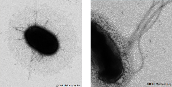 Stain 77 a better stain for technical Negative stain