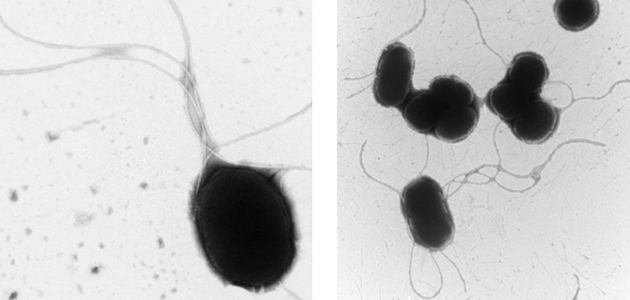 Stain 77 a better stain for technical Negative stain